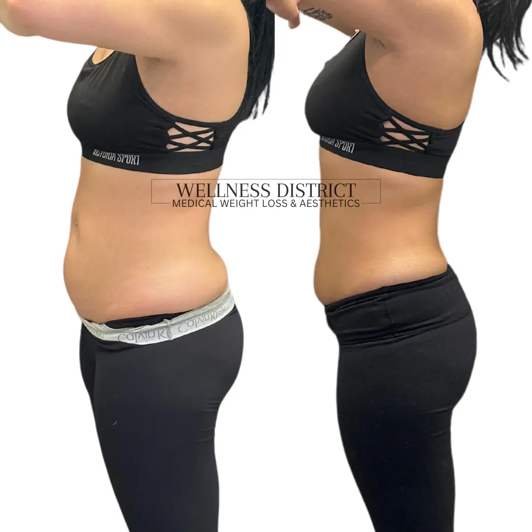 Fargo Medical Weight Loss Before And After Photo