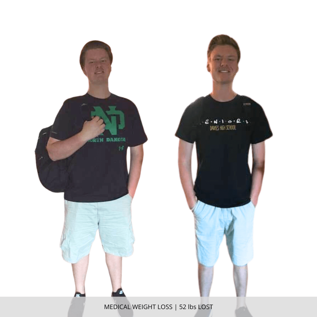Medical Weight Loss | 52 lbs Lost