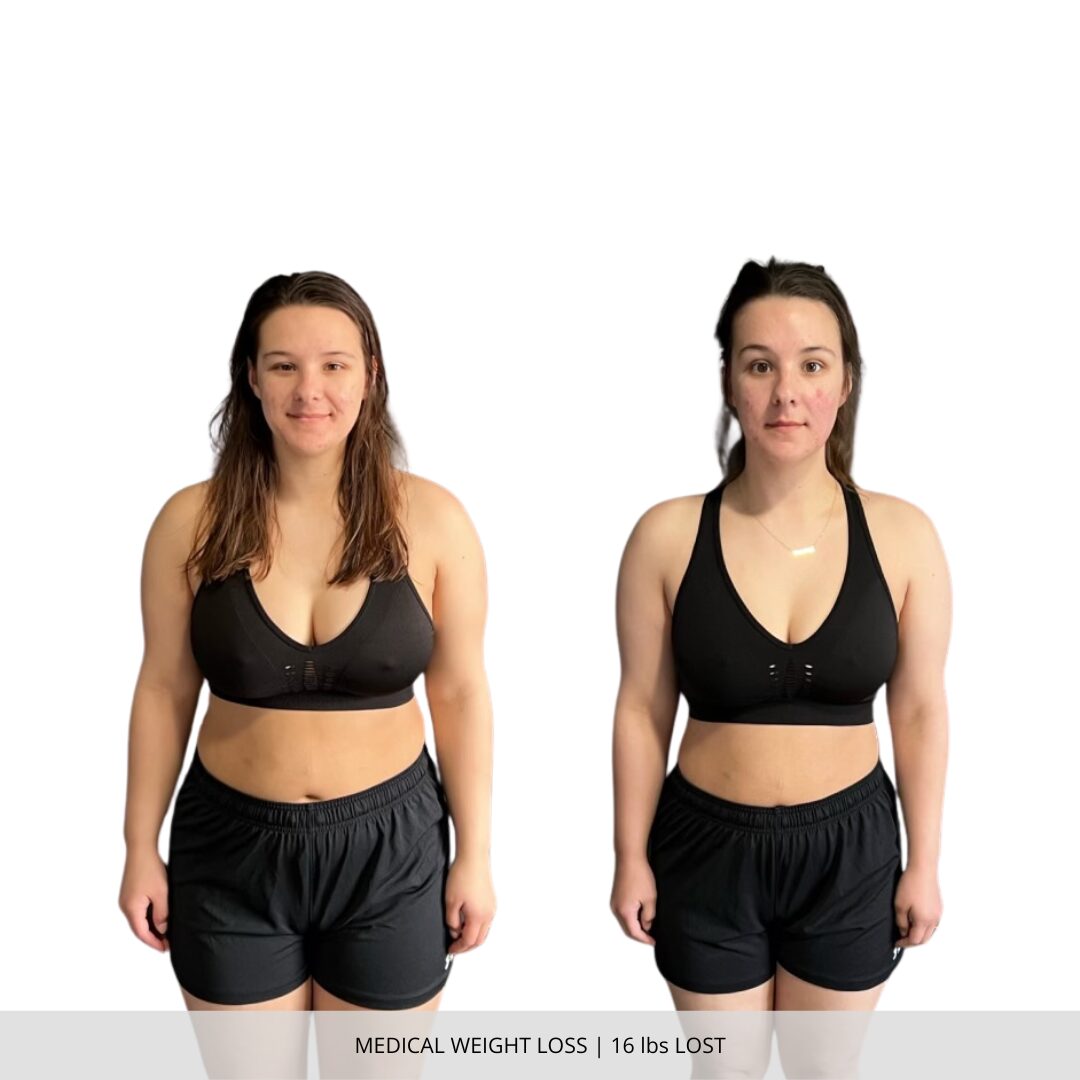 Medical Weight Loss | 16 lbs Lost