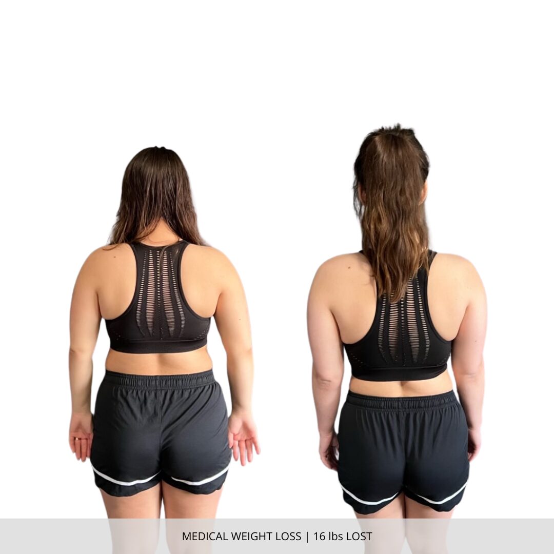 Medical Weight Loss | 16 lbs Lost