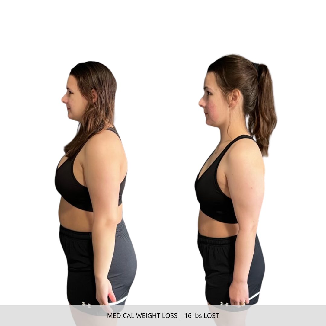 Medical Weight Loss | 16 lbs Lost