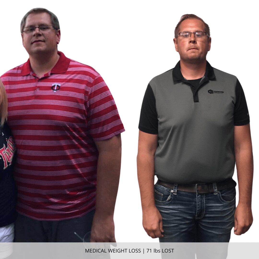 Medical Weight Loss | 71 lbs Lost
