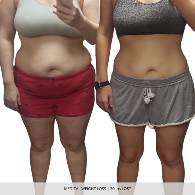 Fargo Medical Weight Loss Before and After
